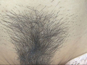 300人のまん毛3　サンプル画像17